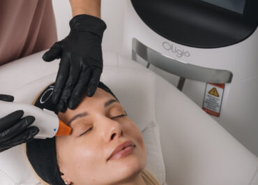 Что такое термолифтинг Oligio?